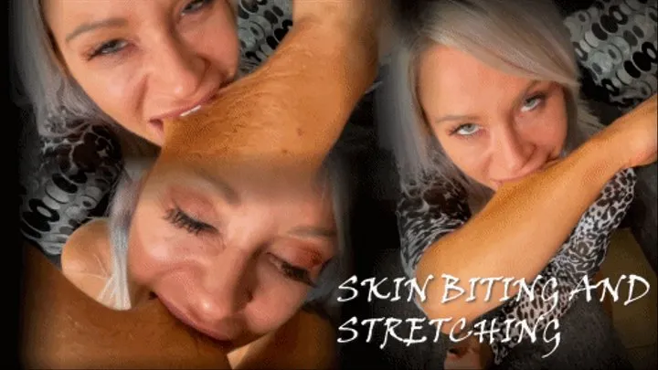 SKIN BITING AND STRETCHING