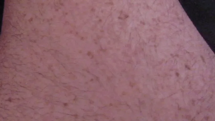 HAIRY LEGS WITH LOTSA FRECKLES