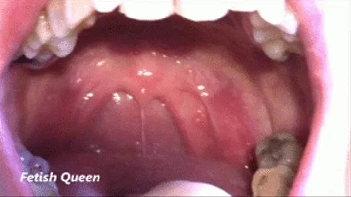 Uvula & Teeth