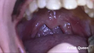 Black Lips Mouth Teeth Uvula