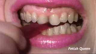 Dirty teeth bite gummy bears