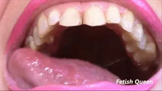 Throat & Teeth