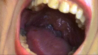 Eve Shows The Uvula And Tonsils