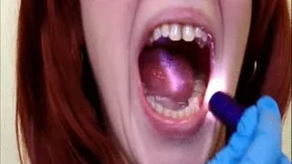 Inside my mouth