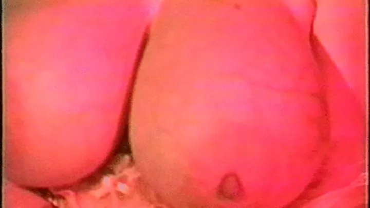 MizTeddi's Breast Expansion History 3