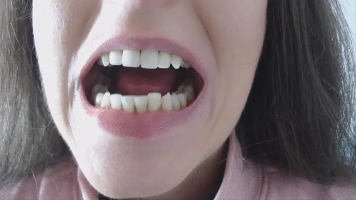 intense teeth check up