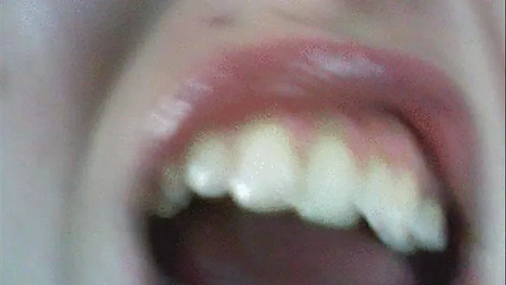 whats happen? a black teeth! and holes in my mouth!!