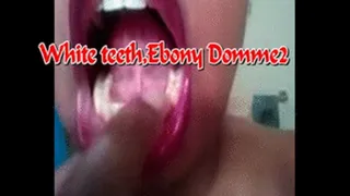 White teeth, Ebony Domme 2