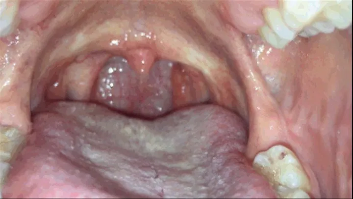 A tour into the inside of my mouth!