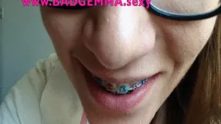 Cum on my braces - will you please?