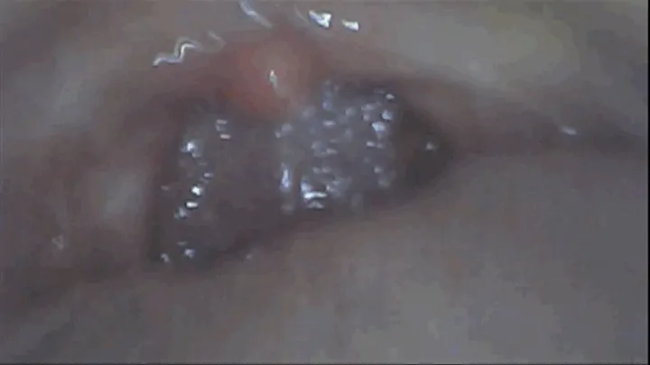 THE BEST ENDOSCOPE FULL MOUTH TOUR.