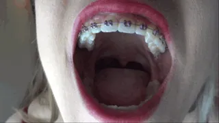 Detailed and brightly lit internal mouth tour