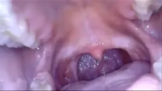 Endoscope Mouth Tour