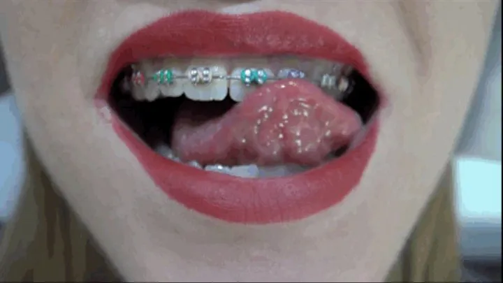 Extreme closeup POV of my braces