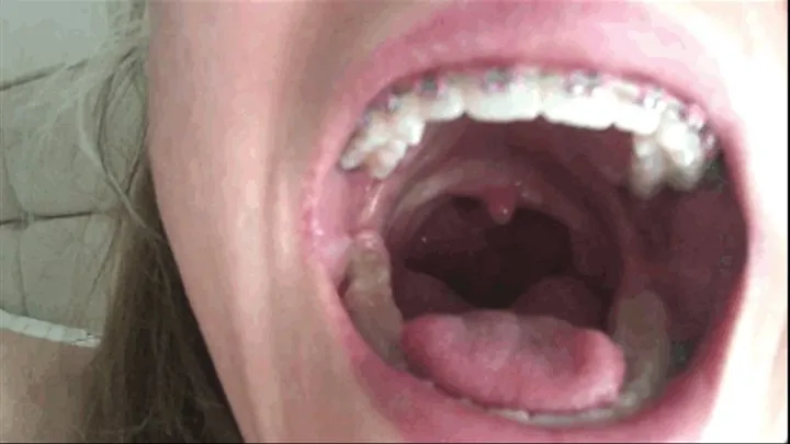 The Dirtiest Mouth