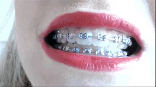 Gorgeous Metal Mouth