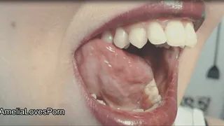 Teeth, Mouth, Tongue, & Throat