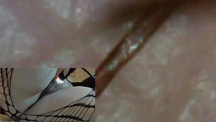 Exploring a hairy pussy under a microscope