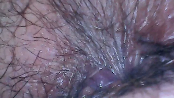 Hairy ass exploration with endoscope and farts