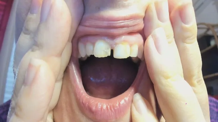 broken teeth in a very close up view avi