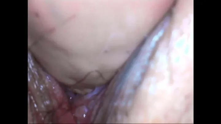 Wonderful endoscope for sperm inside the vagina