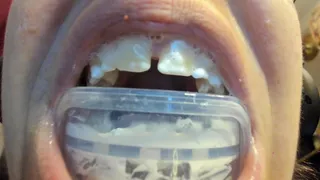 Big mouth and bite for dental treatment