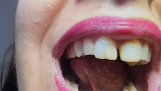 Nicoletta's long canines