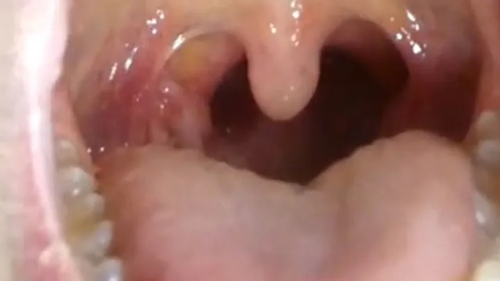 Dental vore - Pill cam teeth and throat full version uncensored