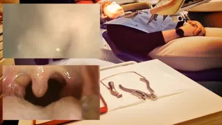 Examination of the mouth, teeth and stomach at the dentist - Pure extreme vore video