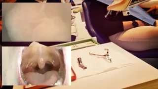 New Experiment - Dental Vore