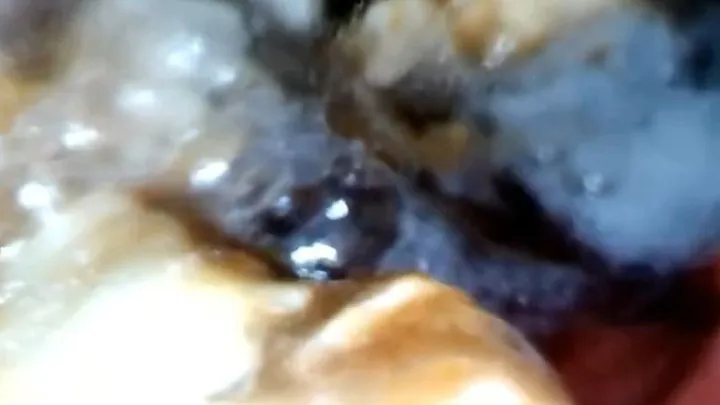 Medical endoscopy PillCam in Full Screen - Eating Pizza with onions and pieces of sausage live digestion