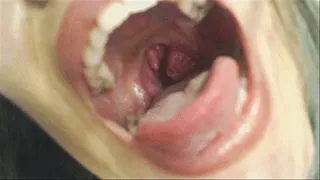 Carmita's Mouth Exploration: BIG Tonsil & Fillings