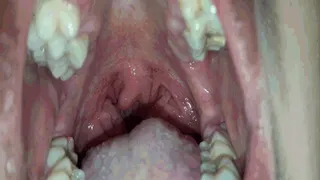 Inside my huge throat