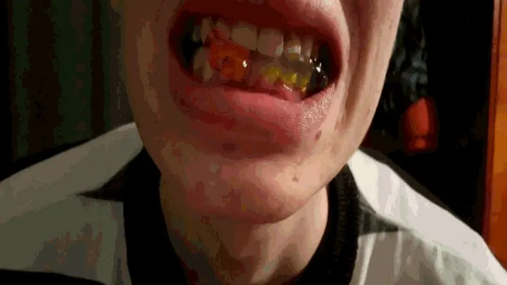 Boy's teeth crush