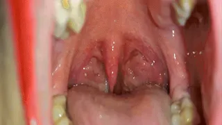 My throat after ice cream