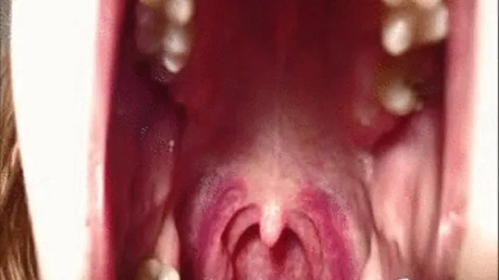 Red throat, swollen tonsils