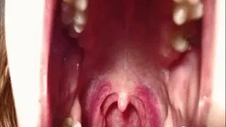 Red throat, swollen tonsils