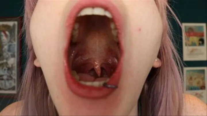 Sick Girl Shows You Her Long, Wiggly Uvula