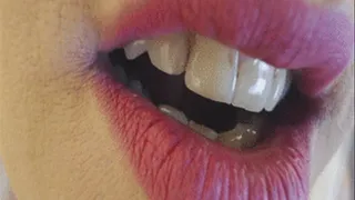 Custom: another teeth show
