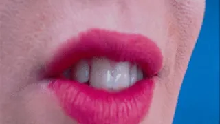 Custom: more of my teeth