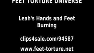 Leah Hands and Feet Burning part 1 of 2