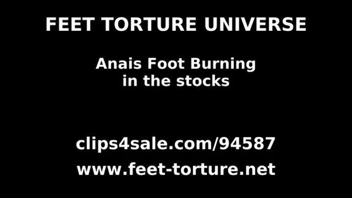 Anais Foot Burning in the Stocks part 1 of 4