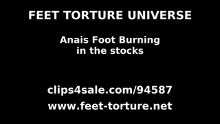 Anais Foot Burning in the Stocks part 1 of 4