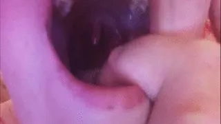 Uvula and Mouth Inspection