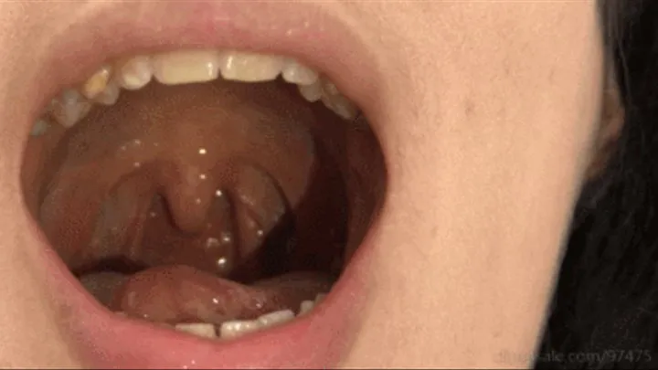 My uvula (First uvula and tonsils video)
