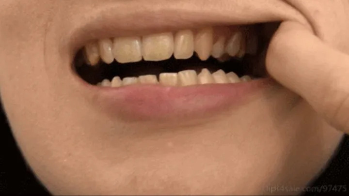 Mouth tour - Showing you my teeth and mouth