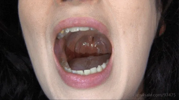 Mouth close-up and uvula (inside mouth, tonsils, uvula)