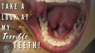 Take A Look At My Terrible Teeth!