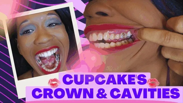 Cupcake's Crown & Cavities: MODDED MOUTH TOUR IN