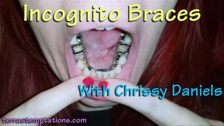 Incognito Braces - Chrissy Daniels